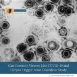 Can-Common-Viruses-Like-COVID-19-and-Herpes-Trigger-Brain-Disorders:-Study-The-Aartery-Chronicles-TAC