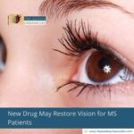 New Drug May Restore Vision for MS Patients