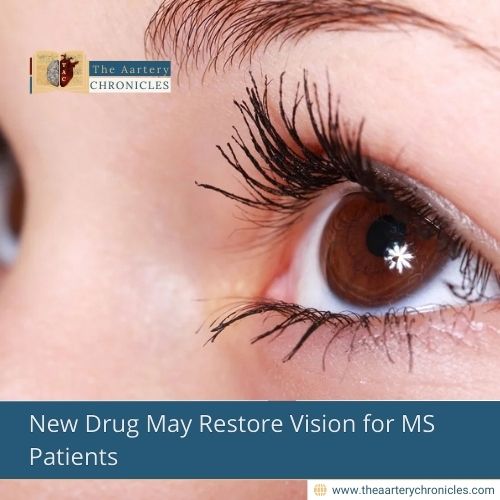 New Drug May Restore Vision for MS Patients