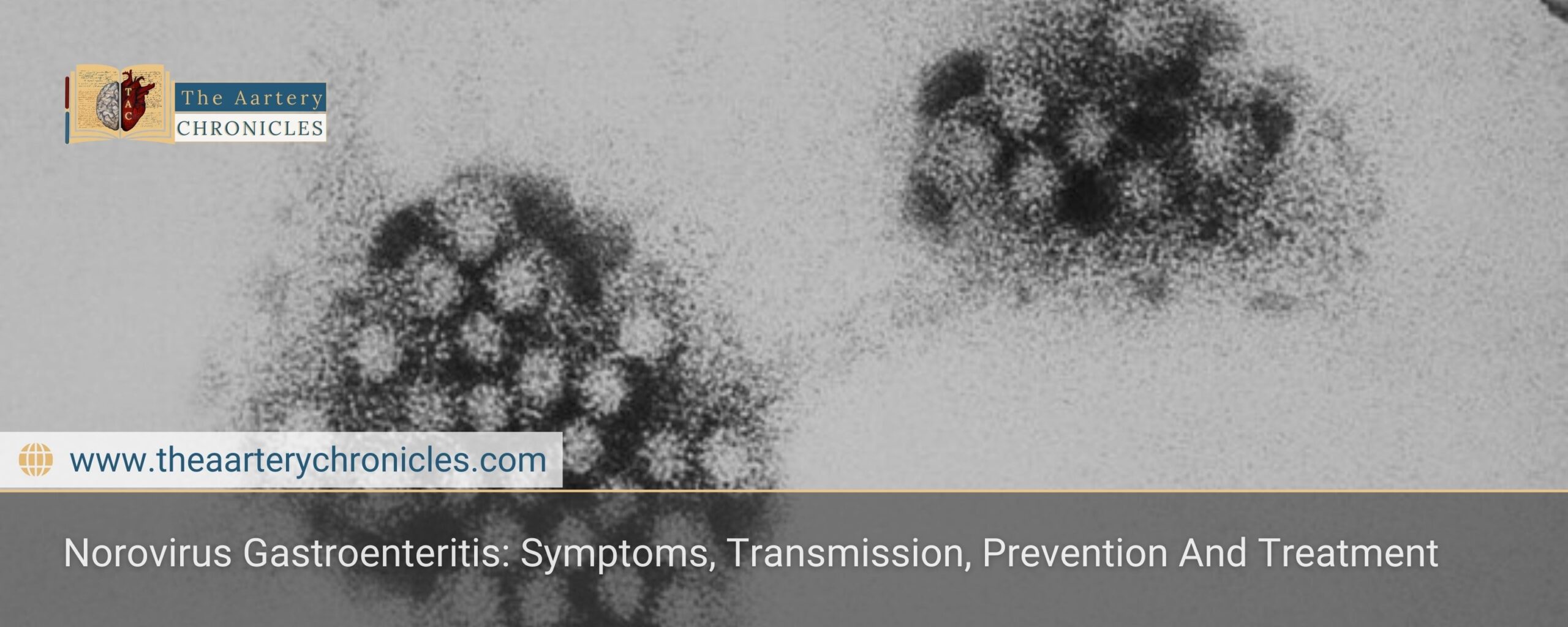 Norovirus-Gastroenteritis:-Symptoms,-Transmission,-Prevention-And-Treatment-The-Aartery-Chronicles-TAC