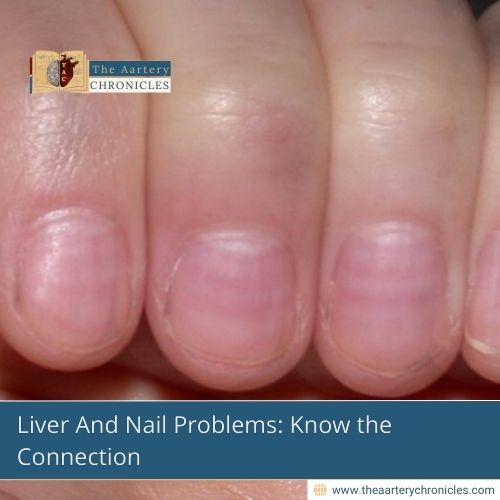 Liver-And-Nail-Problems:-Know-the-Connection-The-Aartery-Chronicles-TAC