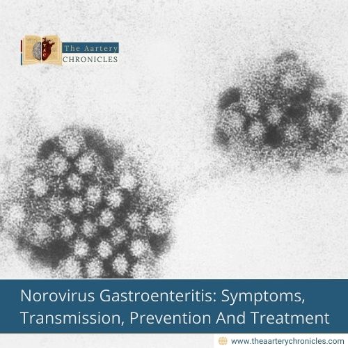 Norovirus Gastroenteritis: Symptoms, Transmission, Prevention And Treatment