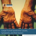 carpal-tunnel-syndrome-everything-that-you-need-to-know-the-aartery-chronicles-tac