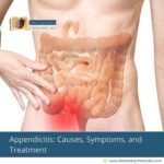 appendicitis-causes-symptoms-treatment-that-you-need-to-know-the-aartery-chronicles-tac