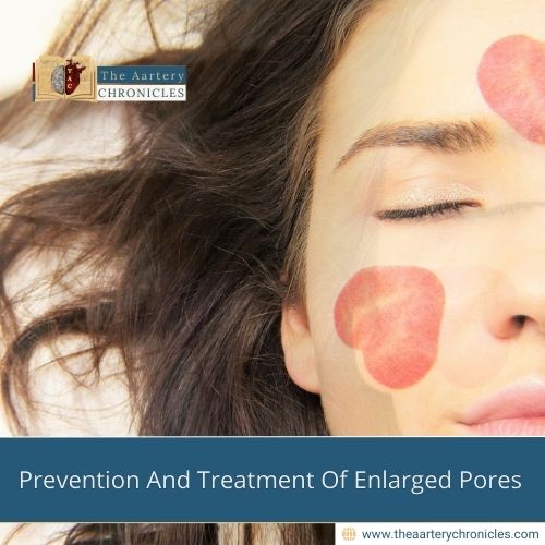 Prevention-And-Treatment-Of-Enlarged-Pores-The-Aartery-Chronicles-TAC