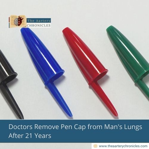 Doctors Remove Pen Cap from Man's Lungs After 21 Years