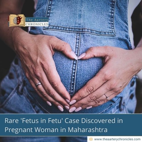 Rare 'Fetus in Fetu' Case Discovered in Pregnant Woman in Maharashtra