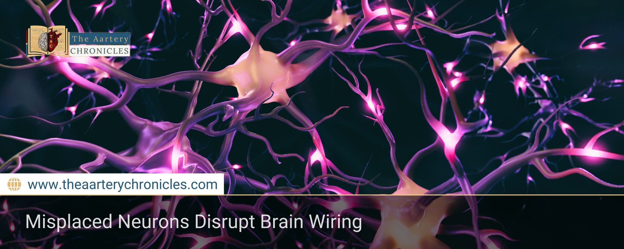 misplaced-neurons-disrupt-brain-wiring-find-out-why-the-aartery-chronicles-tac