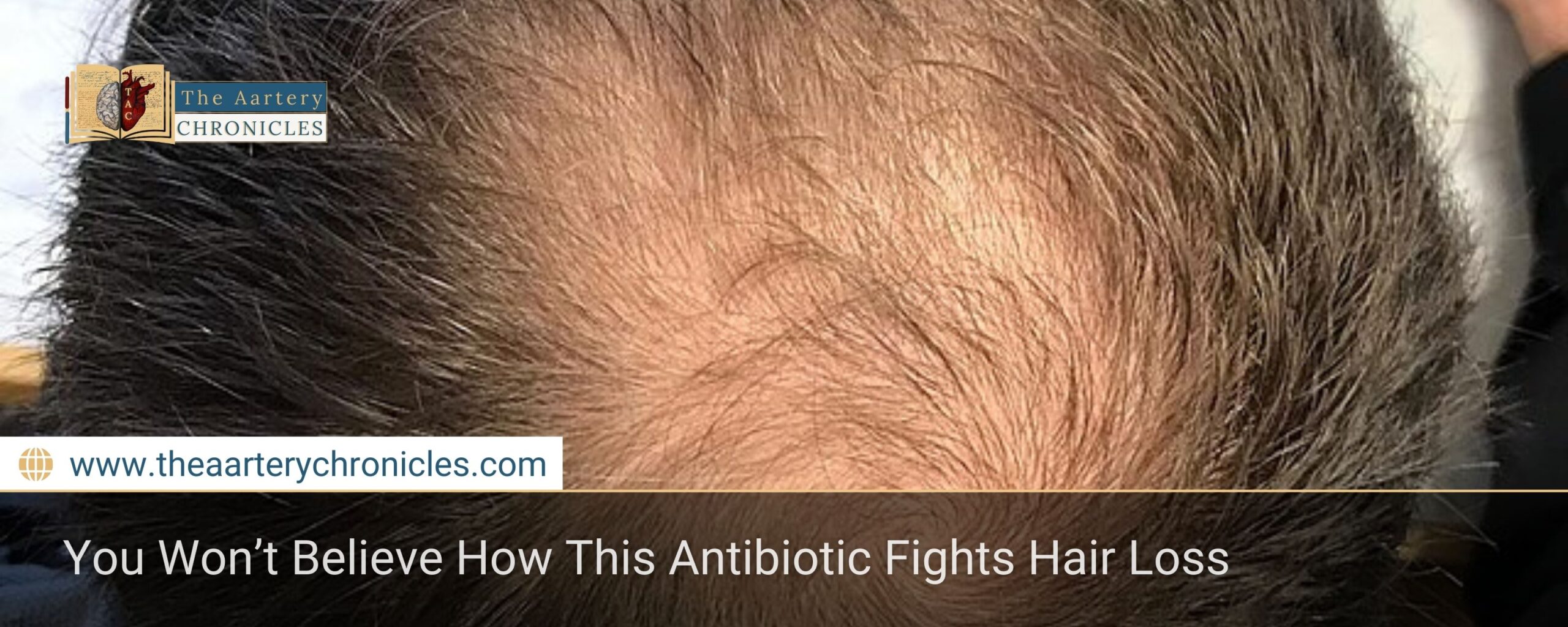 You Won’t Believe How This Antibiotic Fights Hair Loss