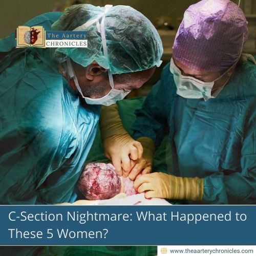 C-Section Nightmare: What Happened to These 5 Women?