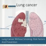 Lung-Cancer-Without-Smoking:-Risk-Factors-And-Prevention-The-Aartery-Chronicles-TAC