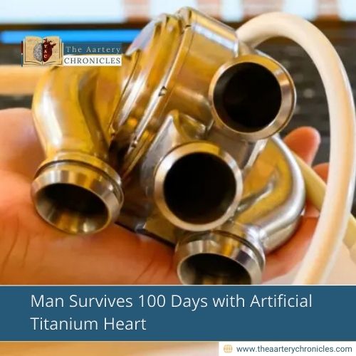 Man Survives 100 Days with Artificial Titanium Heart