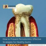 How-to-Prevent-Periodontitis:-Effective-Strategies-for-Healthy-Gums-The-Aartery-Chronicles-TAC