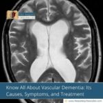 Know-All-About-Vascular-Dementia:-Its-Causes,-Symptoms,-and-Treatment-The-Aartery-Chronicles-TAC
