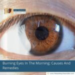 Burning-Eyes-In-The-Morning:-Causes-And-Remedies-The-Aartery-Chronicles-TAC