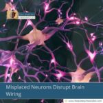 misplaced-neurons-disrupt-brain-wiring-find-out-why-the-aartery-chronicles-tac