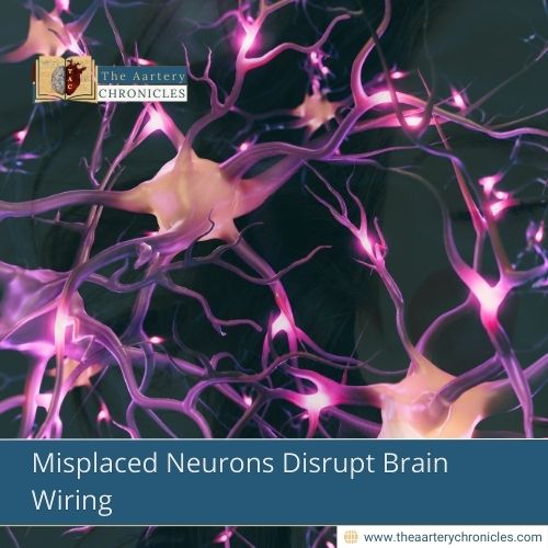 misplaced-neurons-disrupt-brain-wiring-find-out-why-the-aartery-chronicles-tac