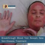 breakthrough-blood-test-reveals-new-skin-disease-treatment-the-aartery-chronicles-tac