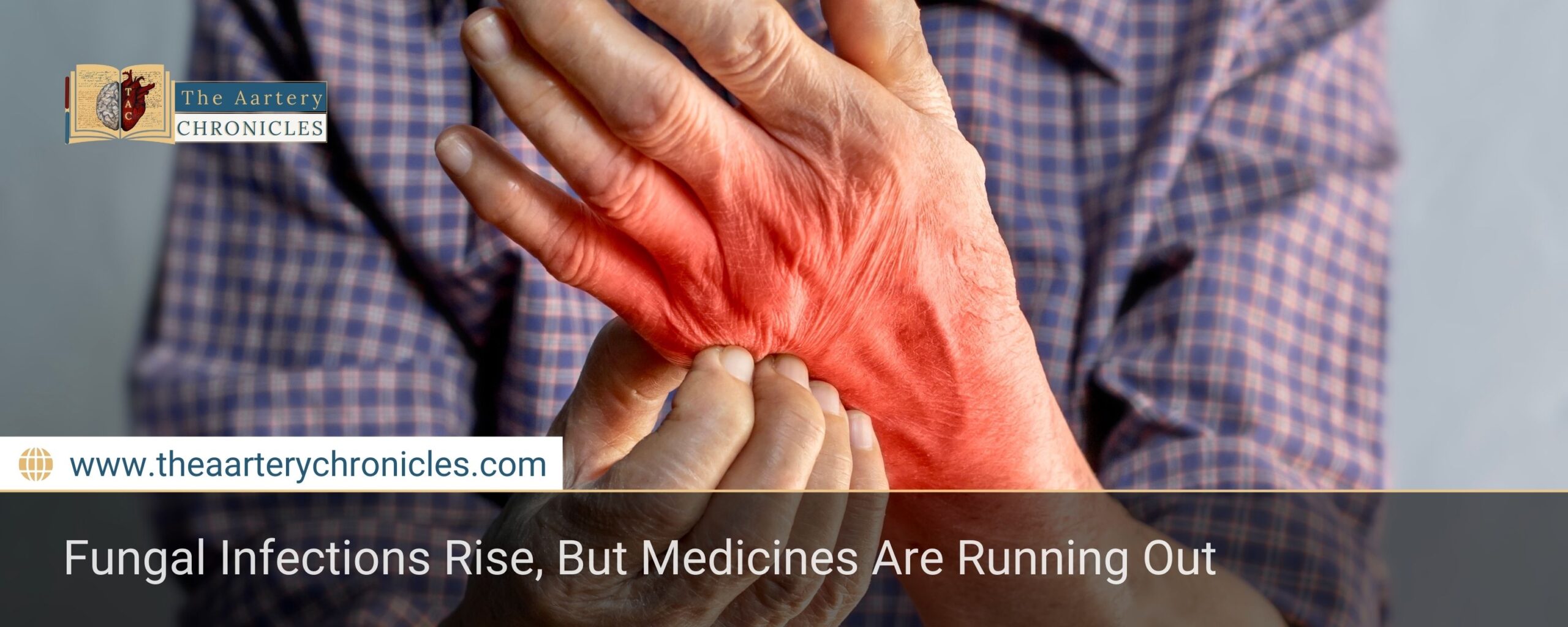 Fungal Infections Rise, But Medicines Are Running Out