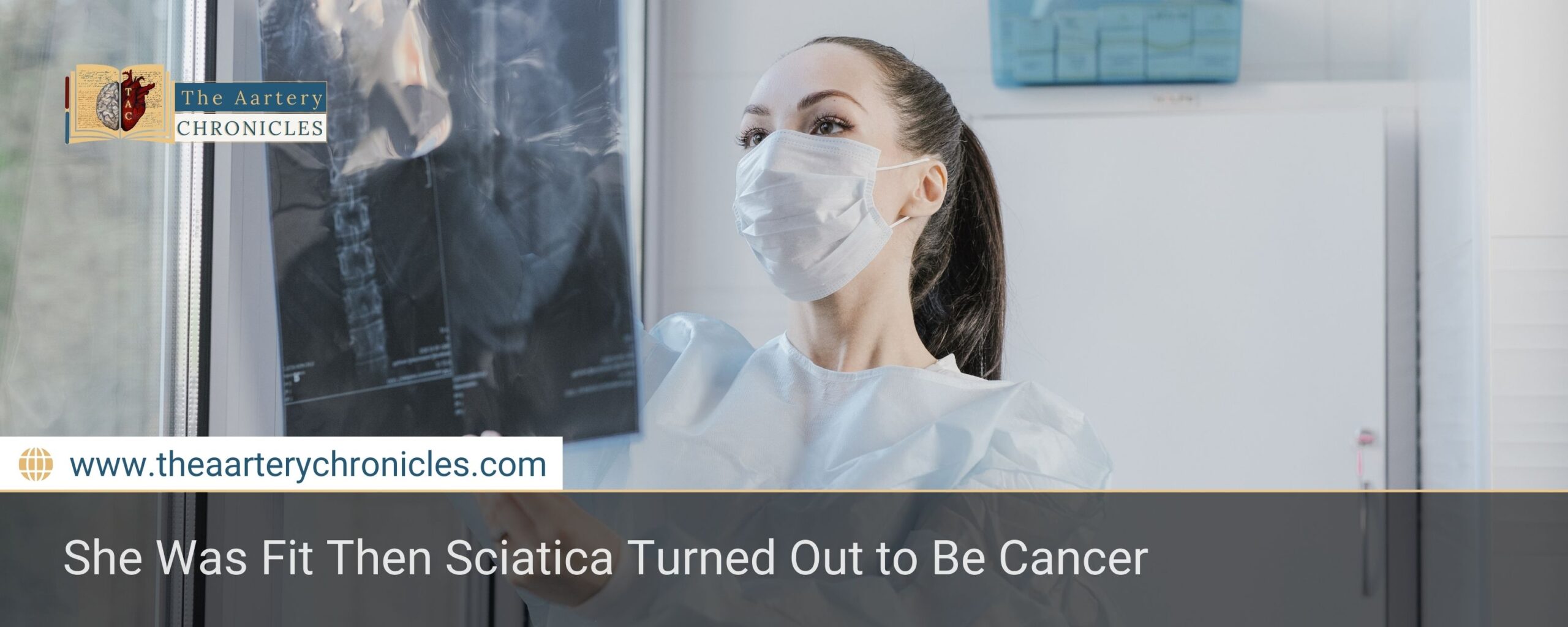 She Was Fit Then Sciatica Turned Out to Be Cancer
