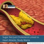 Sugar Not Just Cholesterol Linked to Heart Attacks, Study Warns