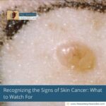 Recognizing-the-Signs-of-Skin-Cancer:-What-to-Watch-For-The-Aartery-Chronicles-TAC