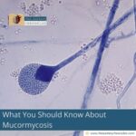 What-You-Should-Know-About-Mucormycosis-The-Aartery-Chronicles-TAC