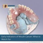 Early-Indicators-of-Mouth-Cancer:-What-to-Watch-For-The-Aartery-Chronicles-TAC