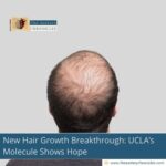 new-hair-growth-breakthrough-uclas-molecule-shows-hope-the-aartery-chronicles-tac