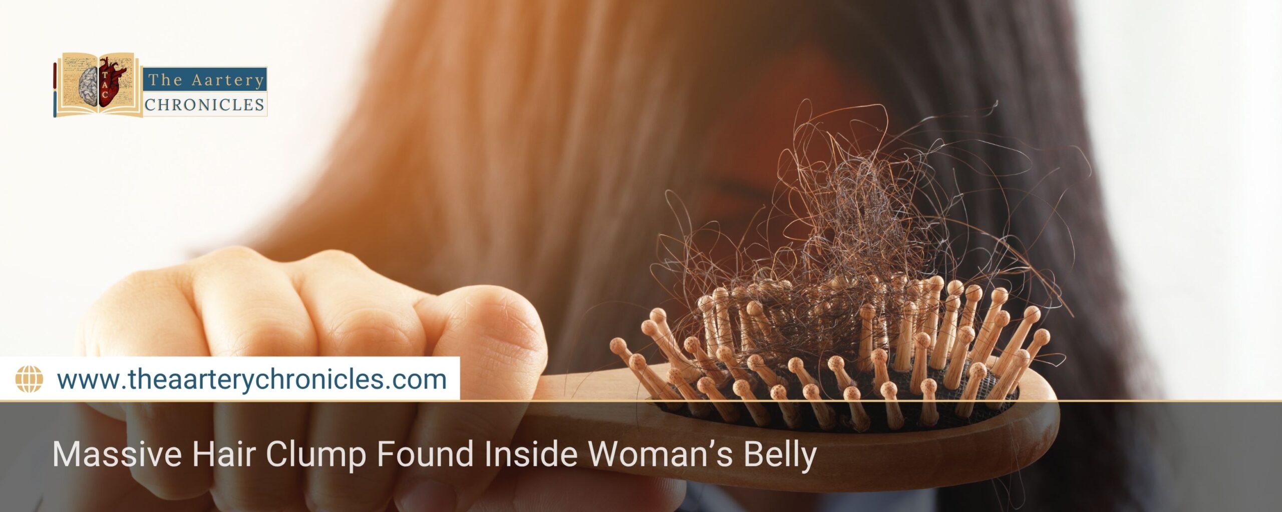 Massive Hair Clump Found Inside Woman’s Belly