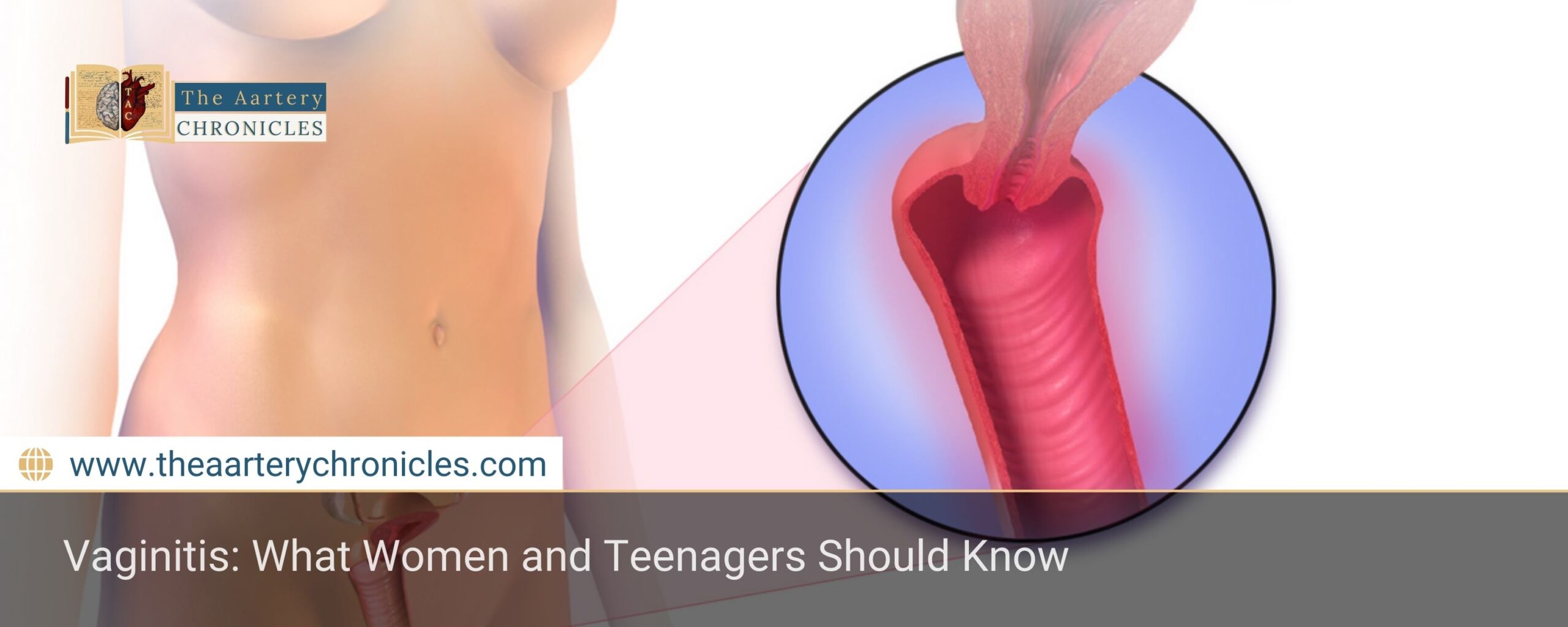 Vaginitis:-What-Women-and-Teenagers-Should-Know-The-Aartery-Chronicles-TAC