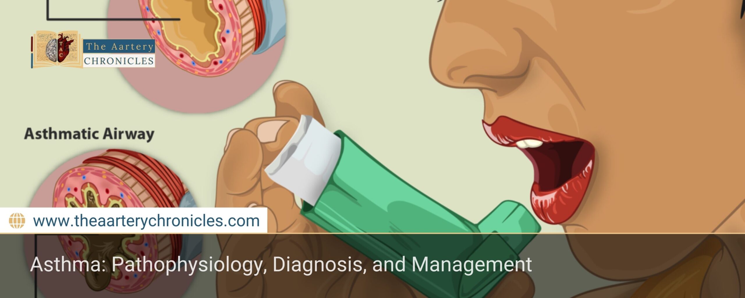 Asthma:-Pathophysiology,-Diagnosis,-and-Management-The-Aartery-Chronicles-TAC