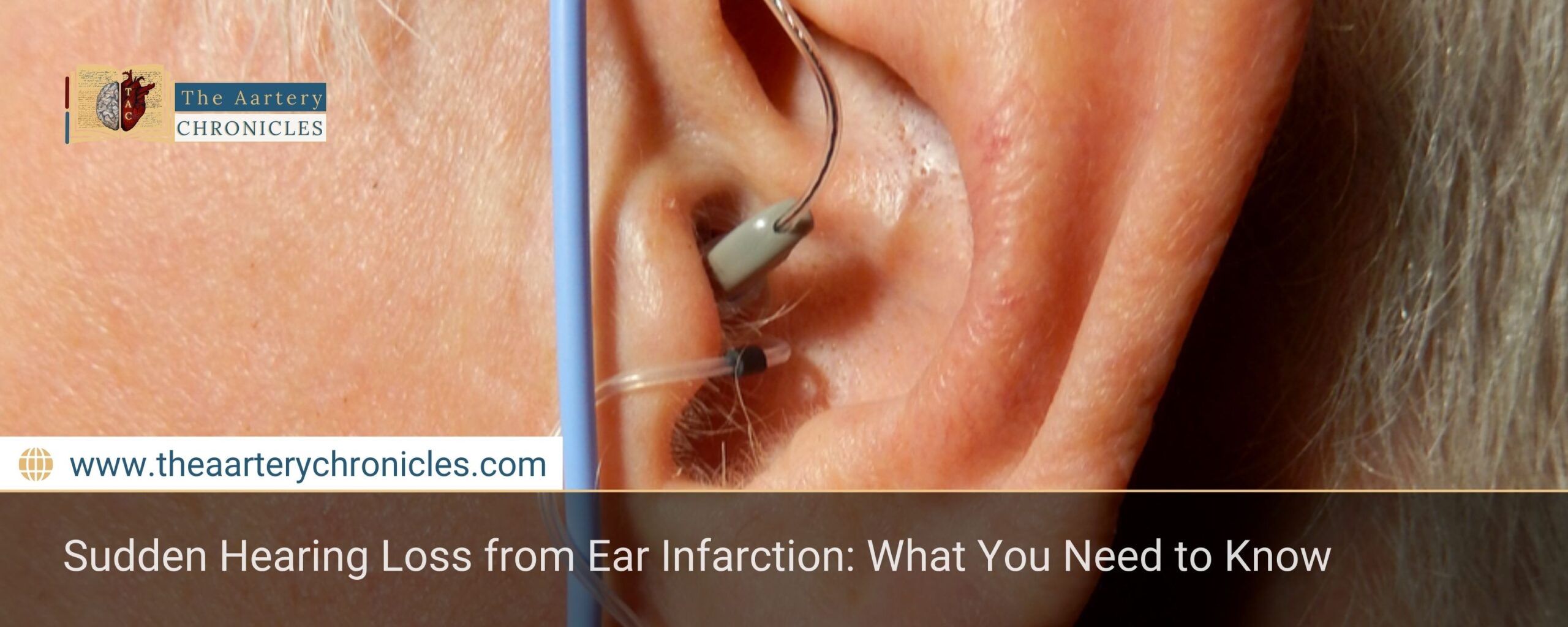 Sudden-Hearing-Loss-from-Ear-Infarction:-What-You-Need-to-Know-The-Aartery-Chronicles-TAC