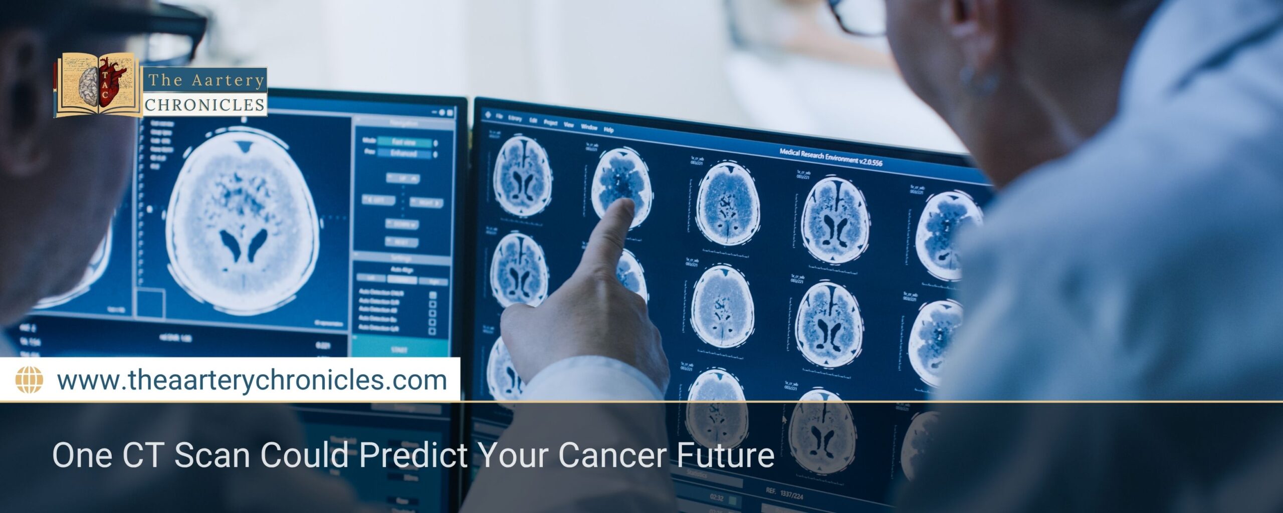 One CT Scan Could Predict Your Cancer Future