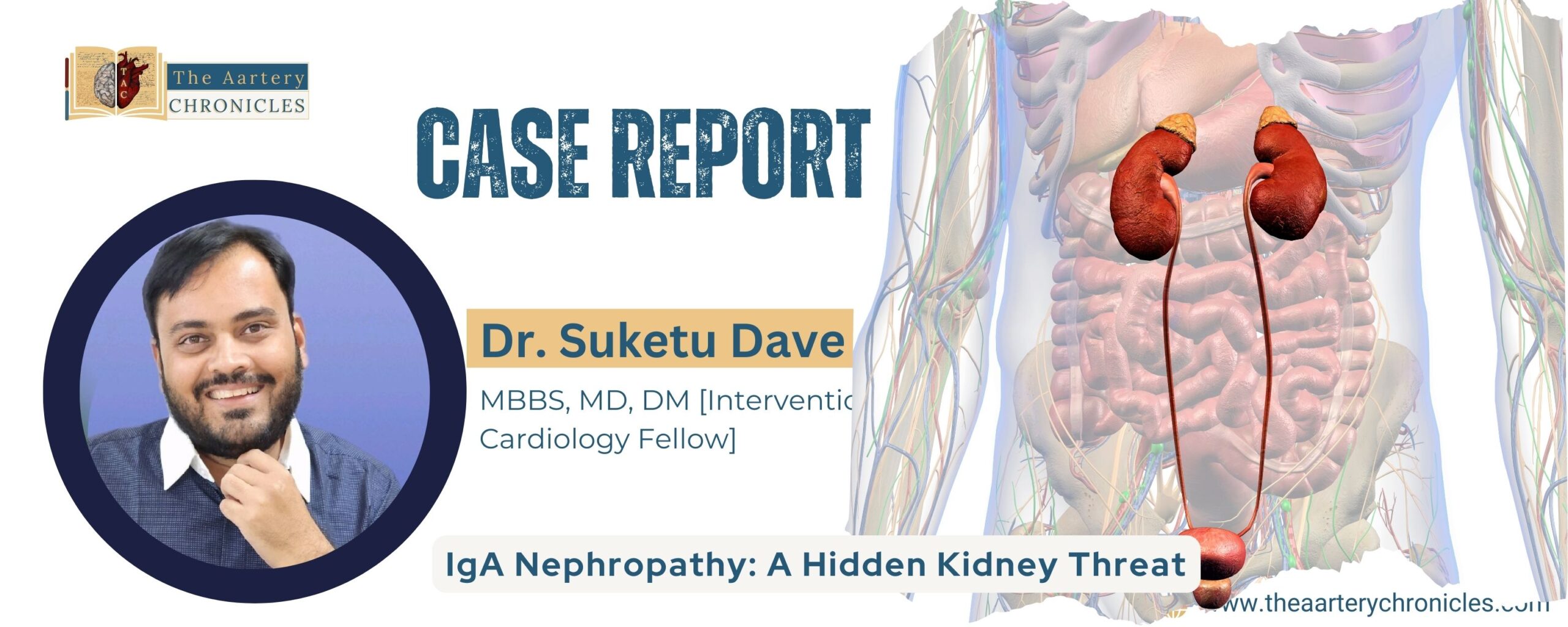 case-study-iga-nephropathy-in-a-hypertensive-patient-the-Aartery-Chronicles-tac