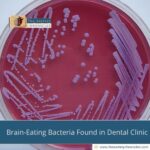Brain-Eating Bacteria Found in Dental Clinic