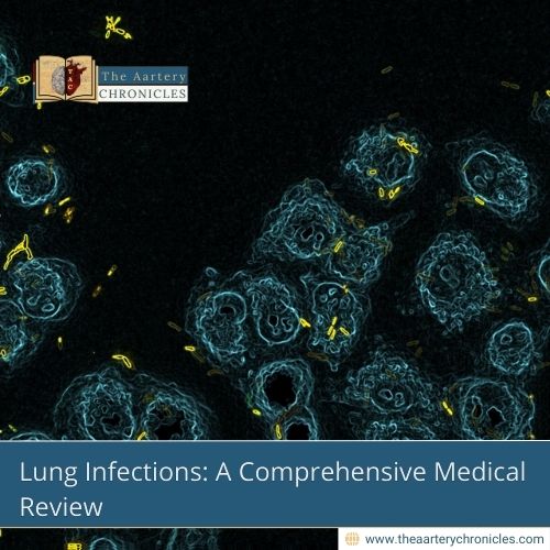 Lung Infections: A Comprehensive Medical Review