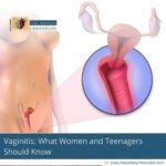 Vaginitis:-What-Women-and-Teenagers-Should-Know-The-Aartery-Chronicles-TAC