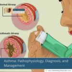 Asthma:-Pathophysiology,-Diagnosis,-and-Management-The-Aartery-Chronicles-TAC