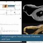 Arrhythmogenic-Heart-Disease:-Overview-and-Care-The-Aartery-Chronicles-TAC