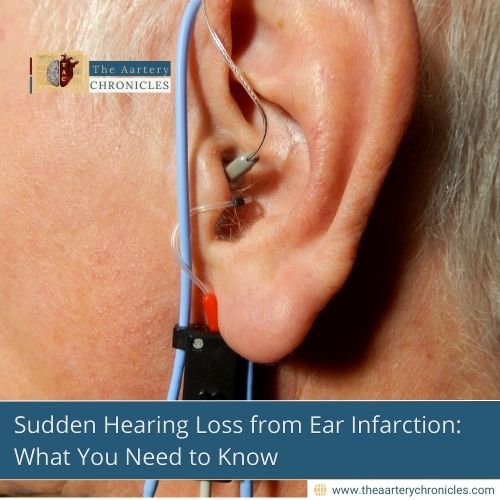 Sudden-Hearing-Loss-from-Ear-Infarction:-What-You-Need-to-Know-The-Aartery-Chronicles-TAC