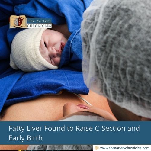 Fatty Liver Found to Raise C-Section and Early Birth