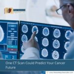 One CT Scan Could Predict Your Cancer Future