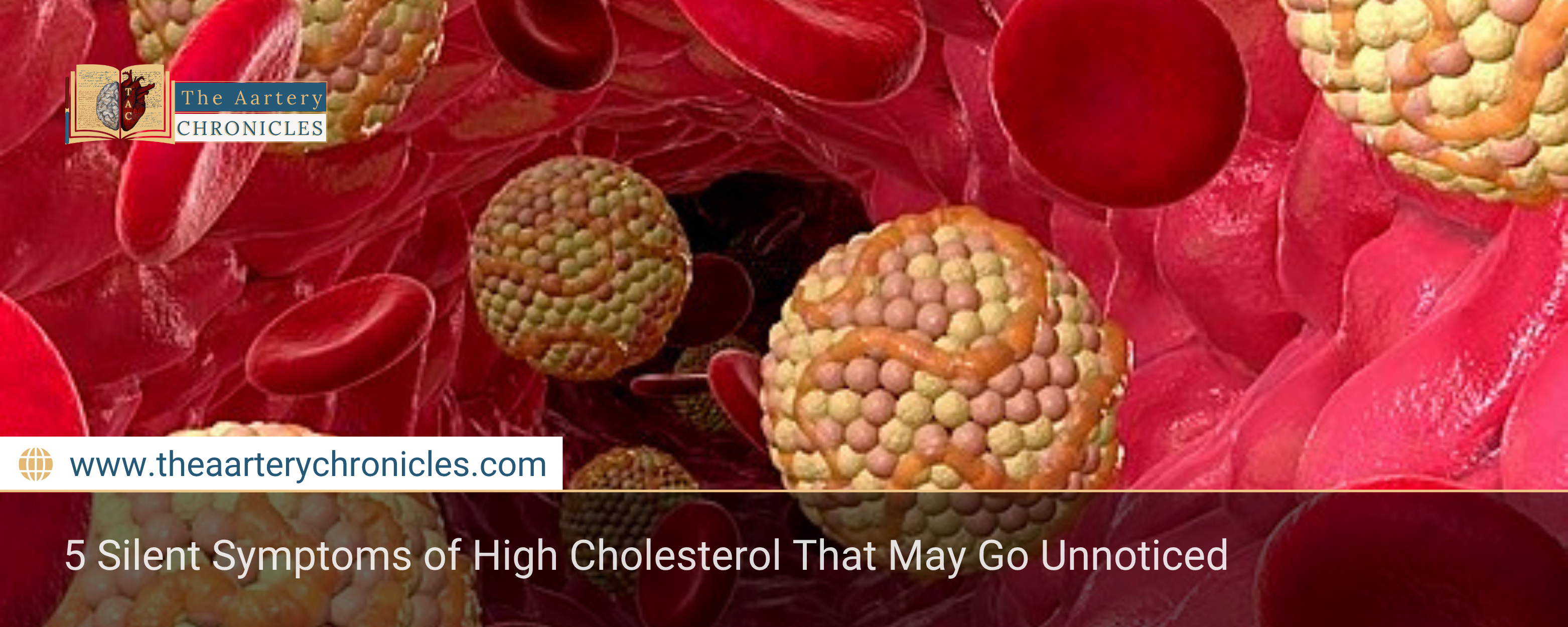 5-Silent-Symptoms-of-High-Cholesterol-That-May-Go-Unnoticed-The-Aartery-Chronicles-TAC