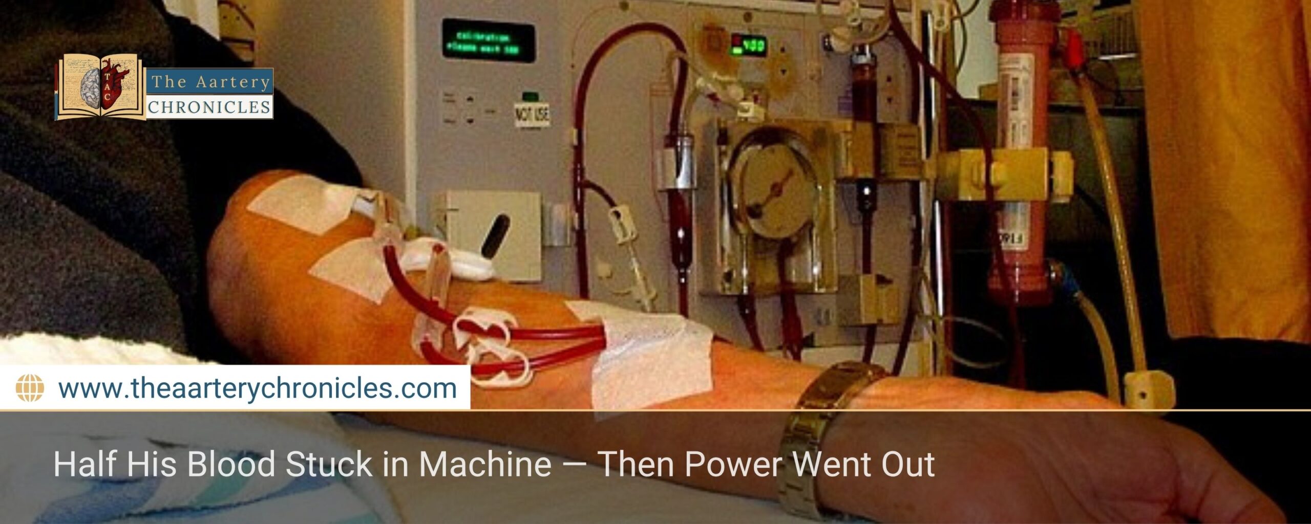 Half His Blood Stuck in Machine — Then Power Went Out