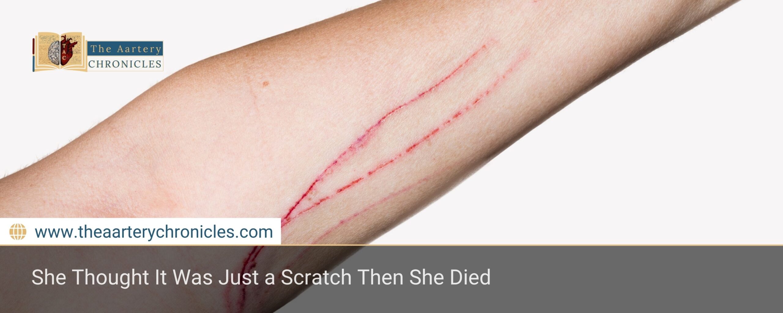 She Thought It Was Just a Scratch Then She Died