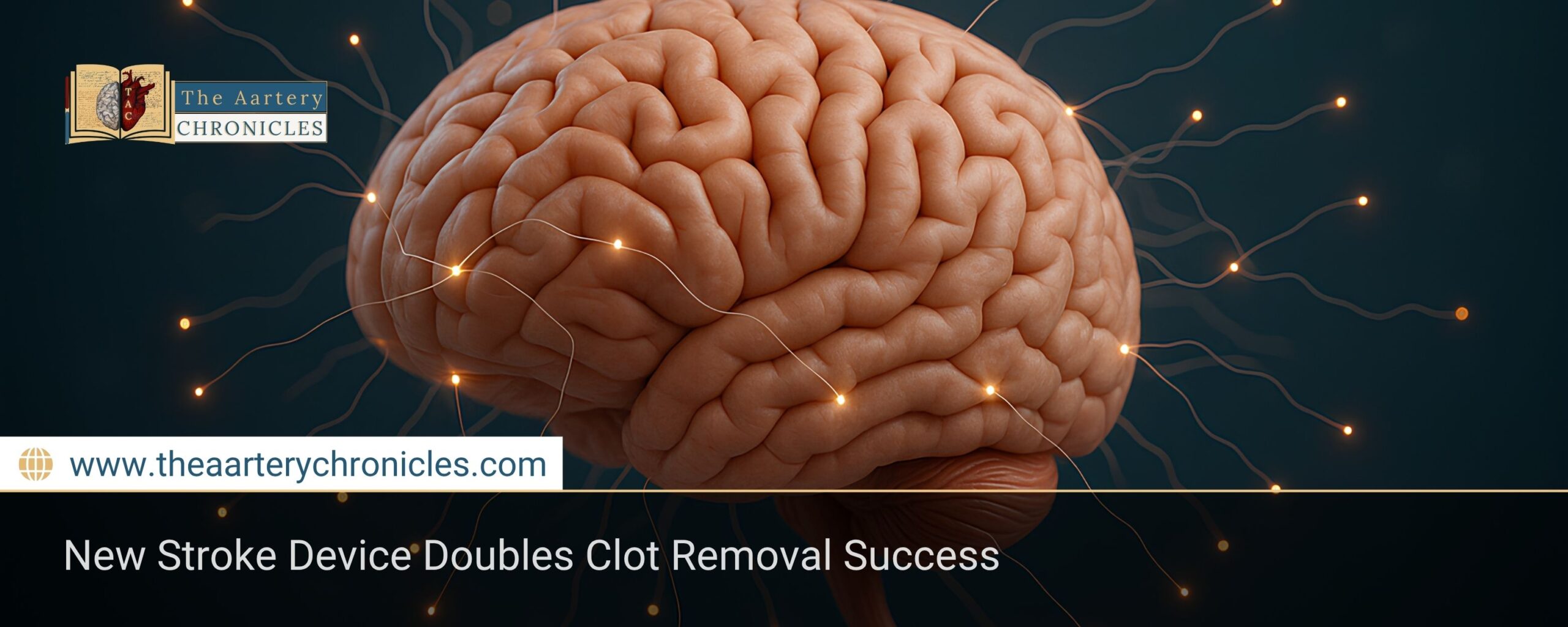 new-stroke-device-doubles-clot-removal-success-the-aartery-chronicles-tac