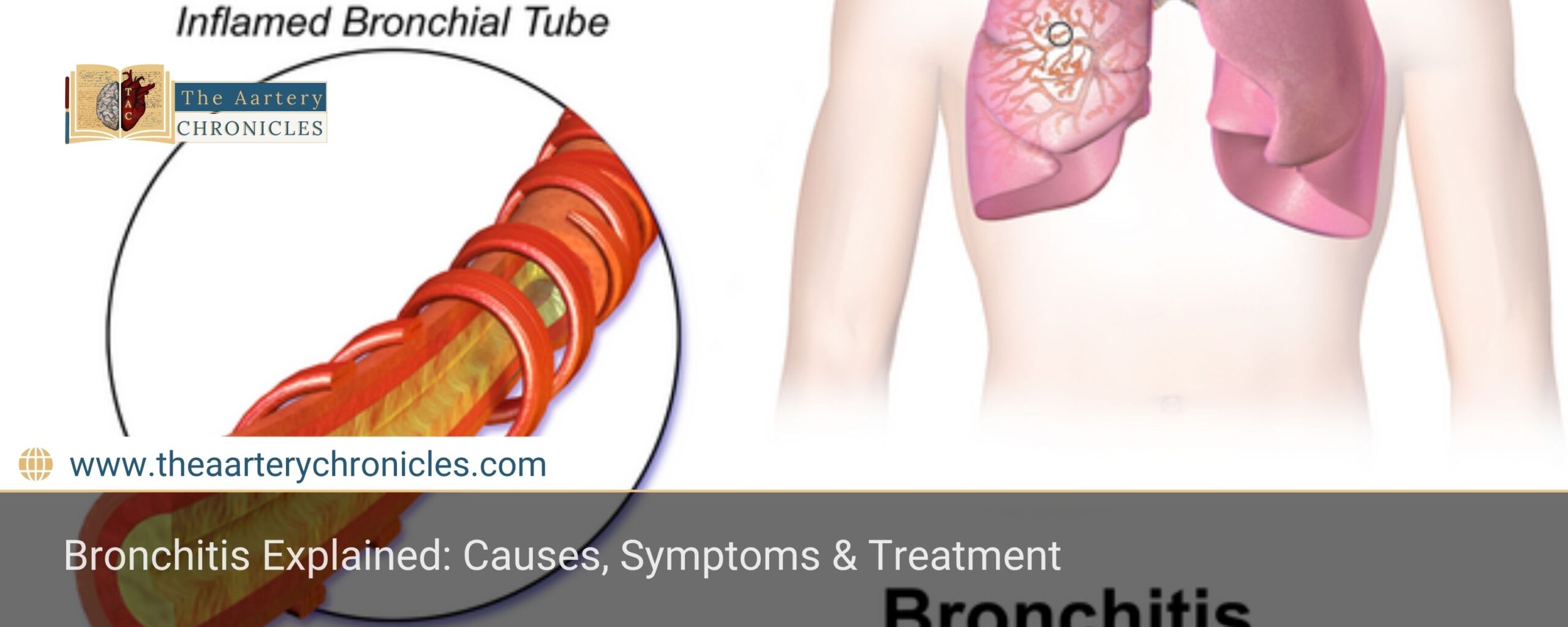 bronchitis-all-you-need-to-know-about-it-the-aartery-chronicles-tac