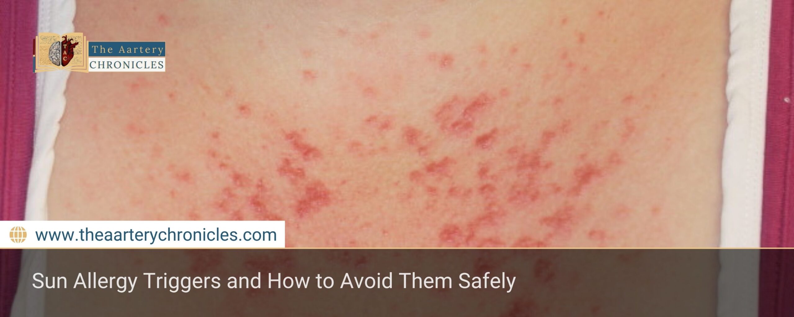Sun-Allergy-Triggers-and-How-to-Avoid-Them-Safely-The-Aartery-Chronicles-TAC