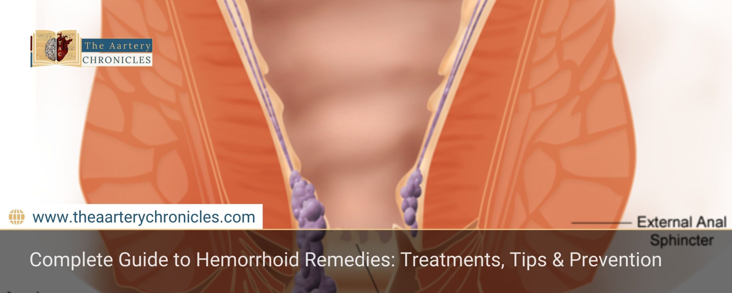Complete-Guide-to-Hemorrhoid-Remedies:-Treatments,-Tips-&-Prevention-The-Aartery-Chronicles-TAC